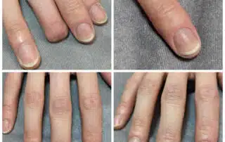 Lifelike Prosthetic Finger