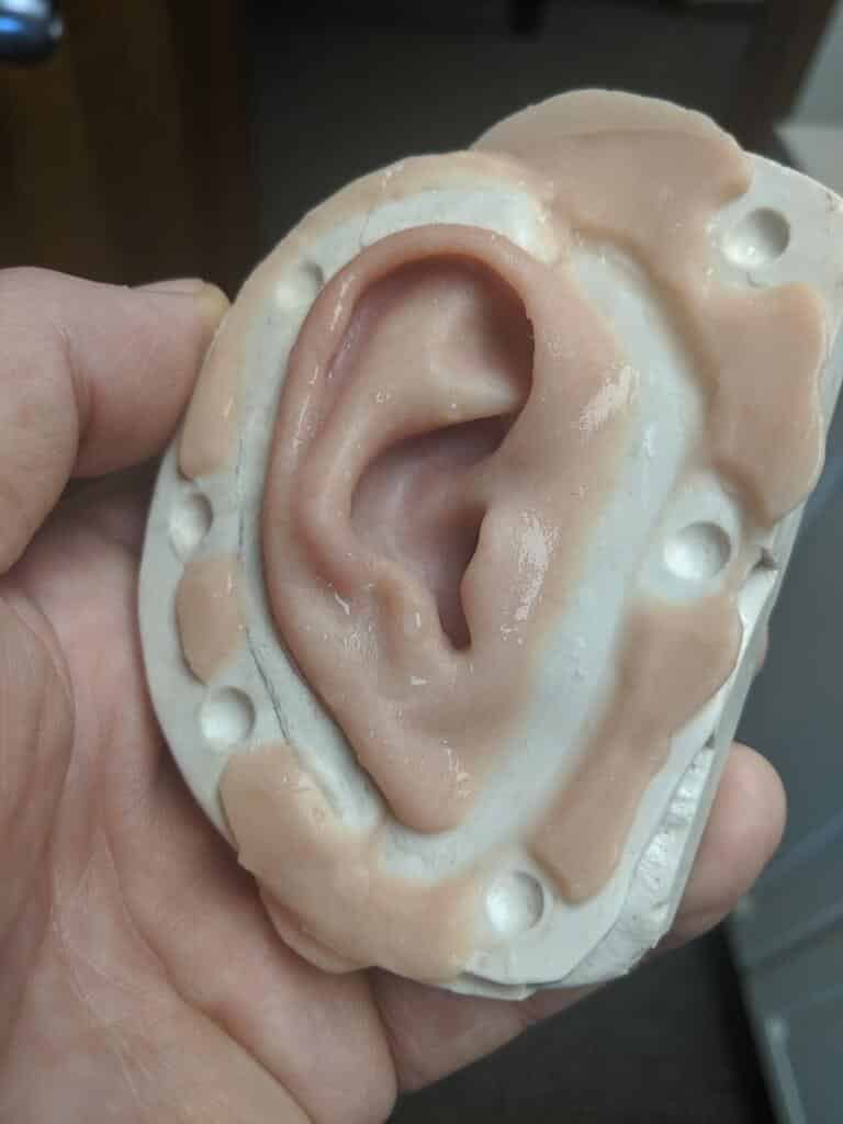 A person 's ear with an injury on it.