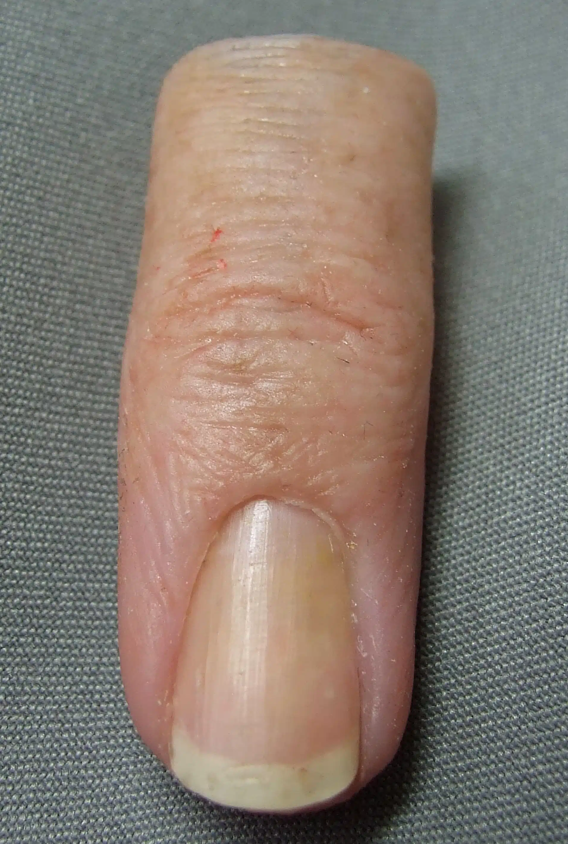 a close up photo of fingertip prosthesis