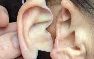 A person is holding the ear of another person