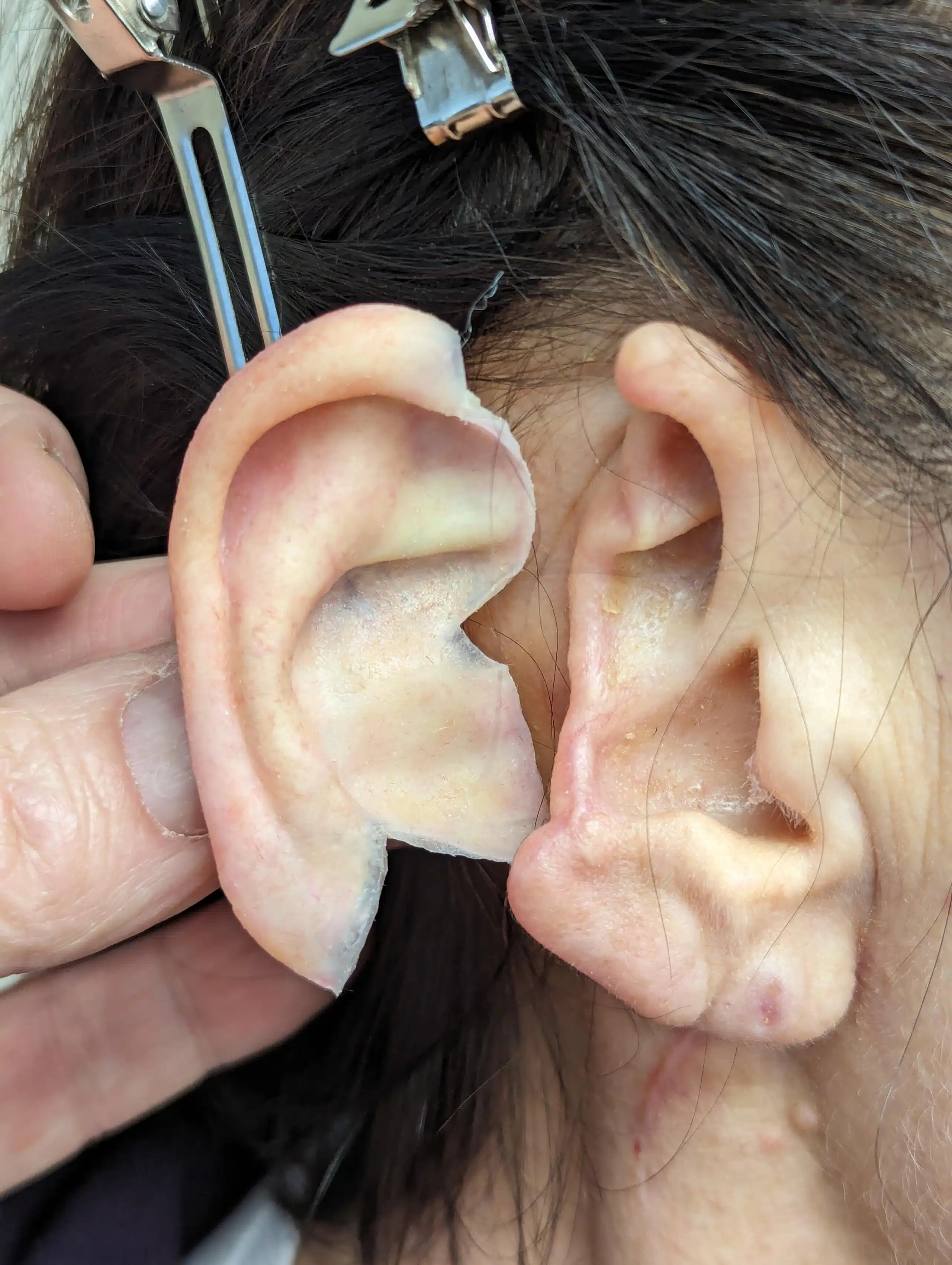 A person is holding the ear of another person