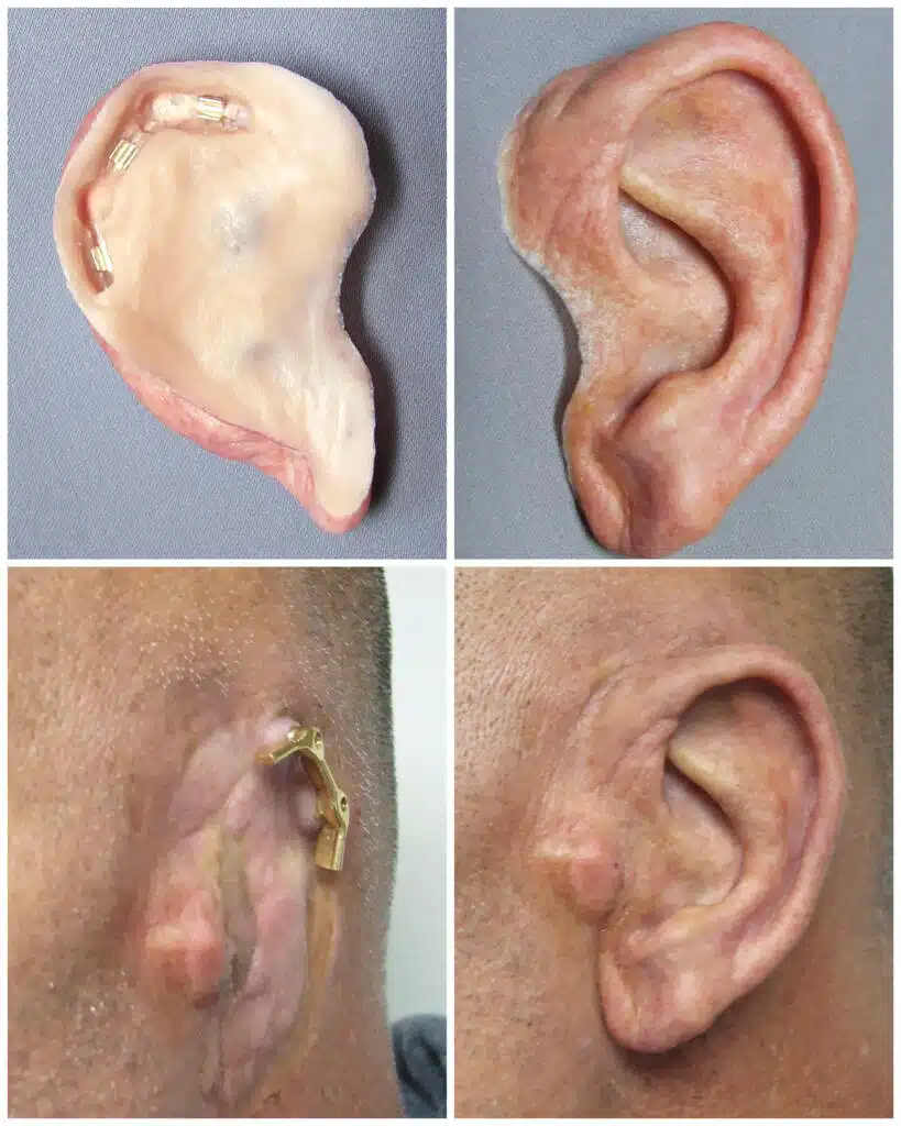A picture of an ear with different parts.