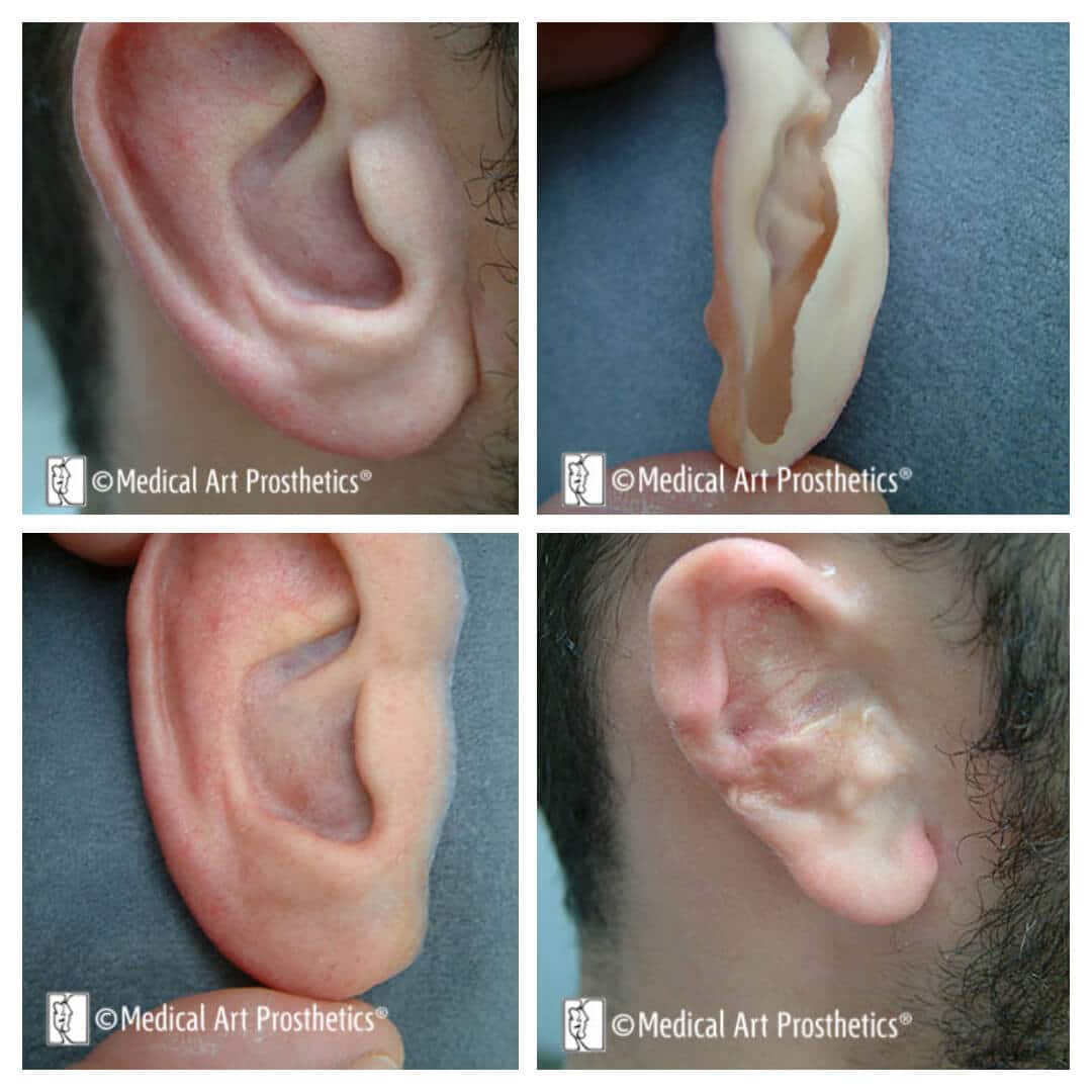 auricular-stories-gabe