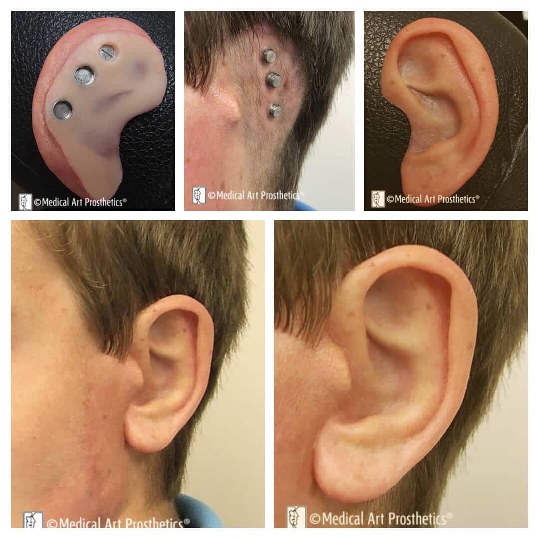 auricular-testimonials-billy