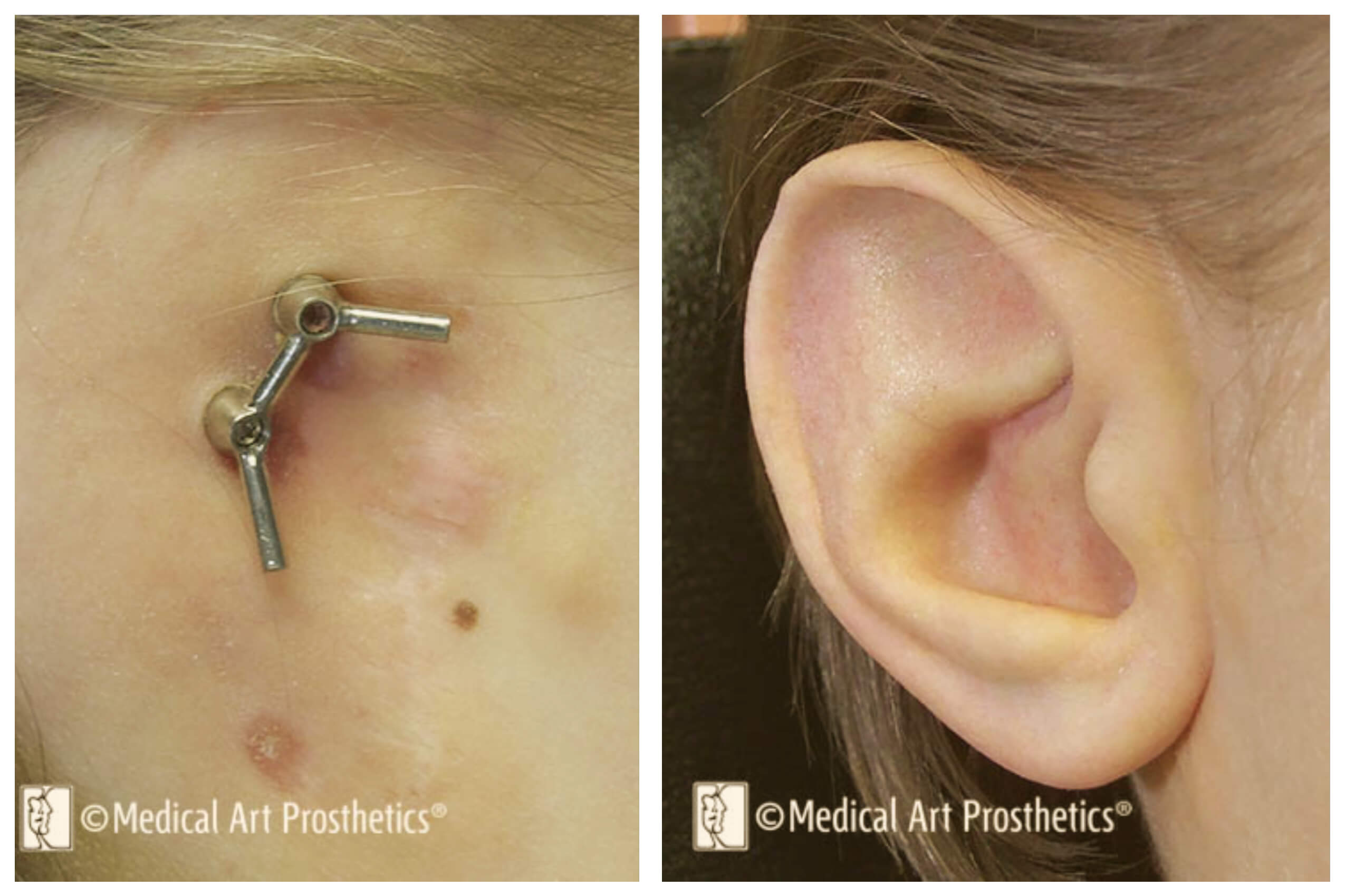 auricular-testimonials-mason