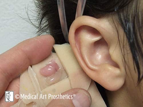 ear-process-cover