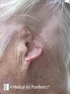 A close up of an older person 's ear