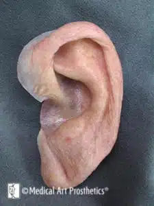 A close up of an ear with the tip of it