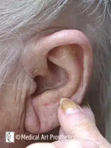 A person touching the ear of an older woman.