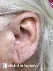 An older person 's ear with a white hair.