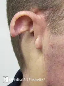 A man with an ear piercing is shown.