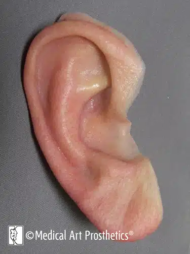 A close up of an ear with the tip missing