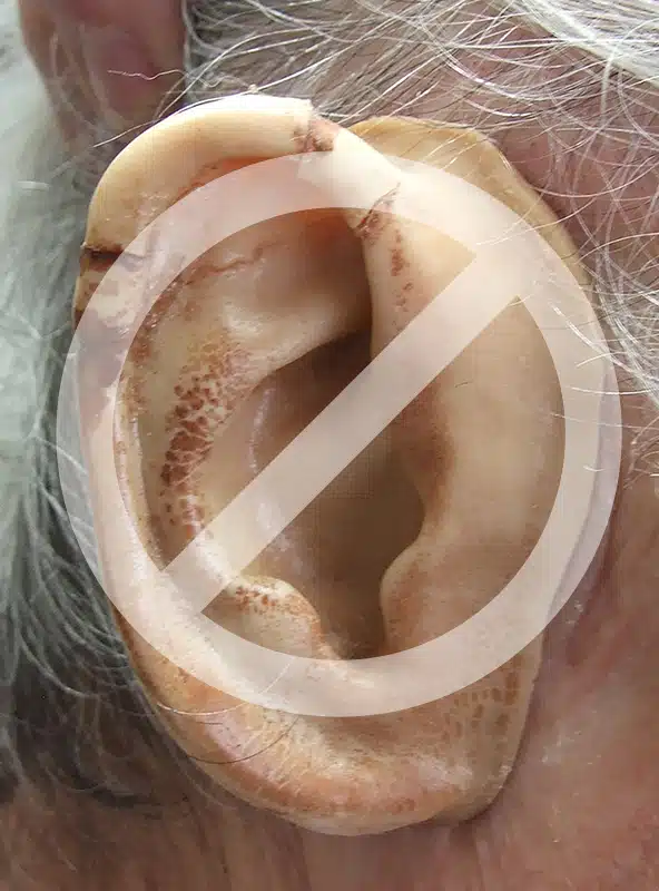 A close up of an ear with the symbol for no