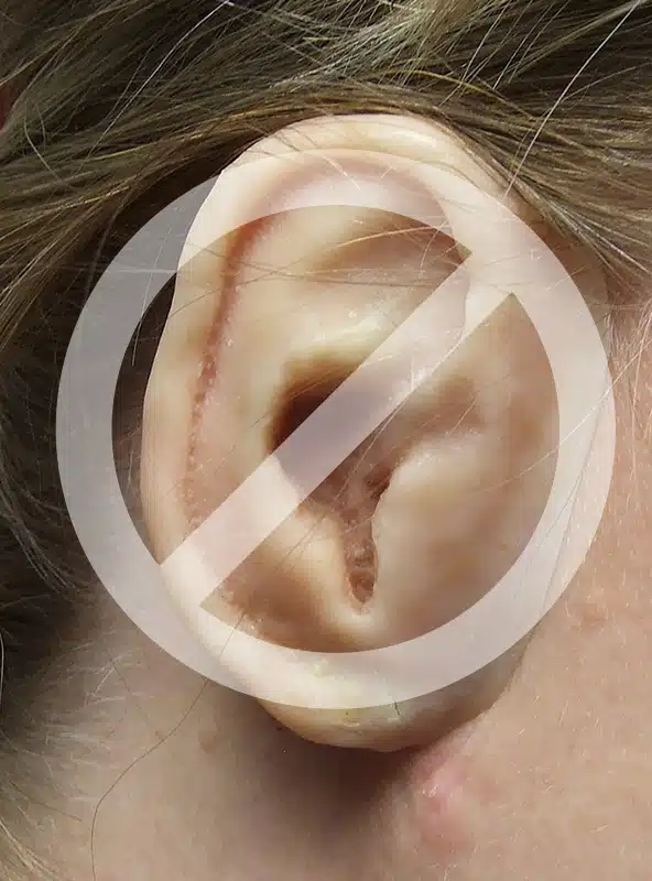 A close up of an ear with the symbol for no