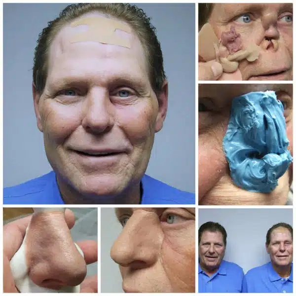 A man with various facial expressions and other medical procedures.