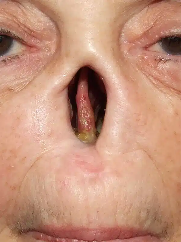 A close up of an older person 's nose with a tongue hanging out.