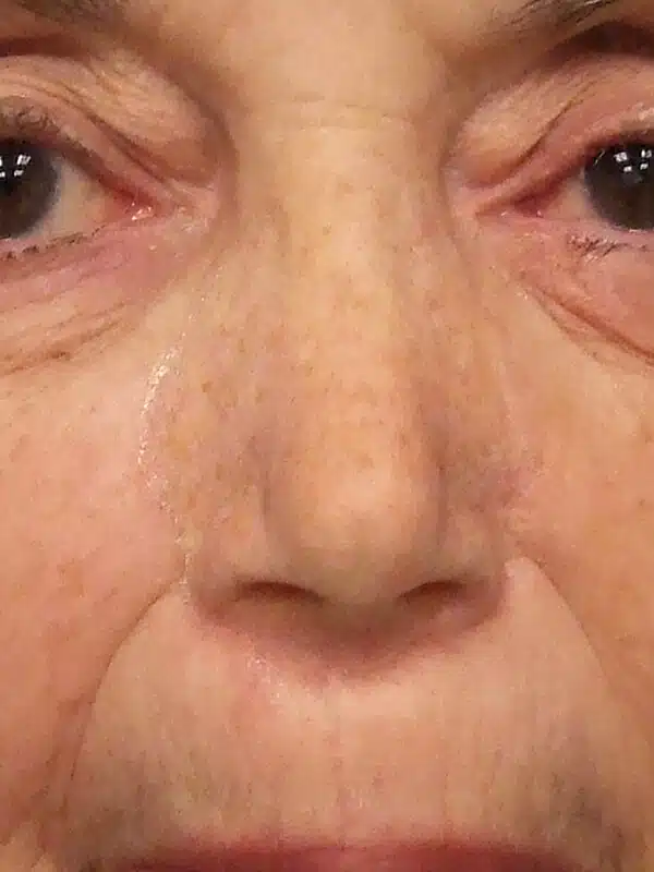 A close up of an older woman 's eyes