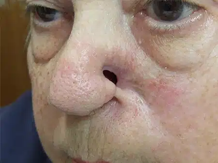 A woman with a nose ring and a large nose.