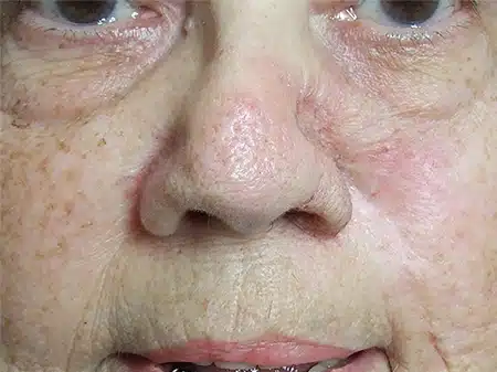 A close up of an older person 's face