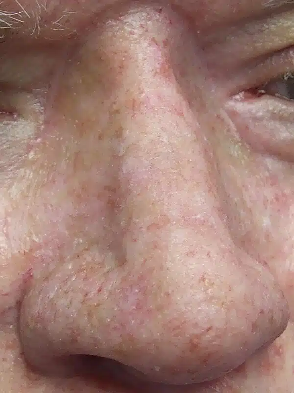 A close up of the face of an older person