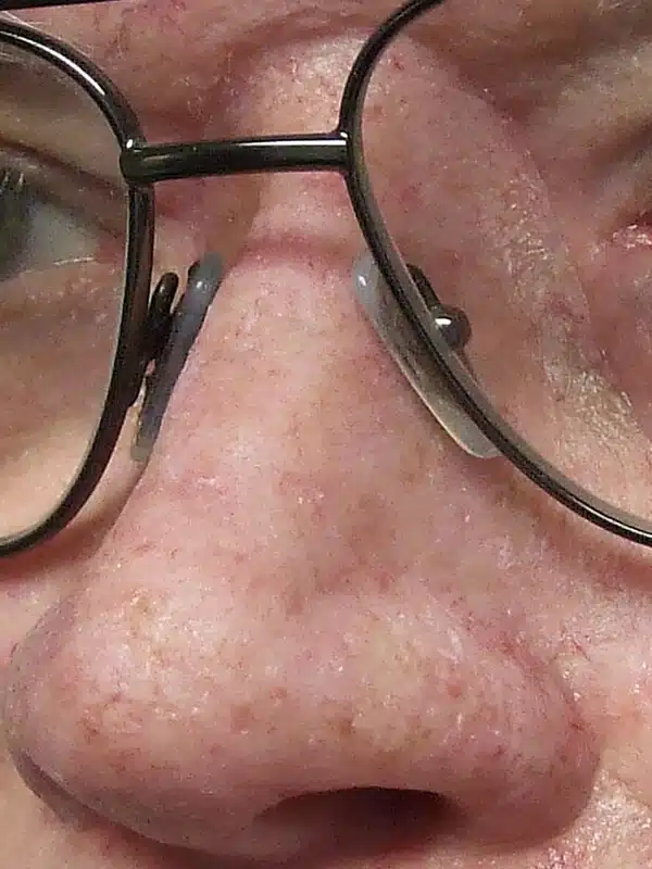 A close up of the face and glasses of an older person