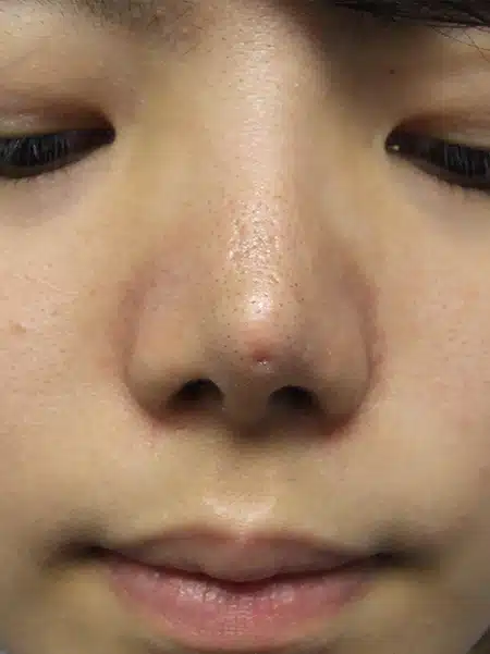 A close up of the nose and face of a person.