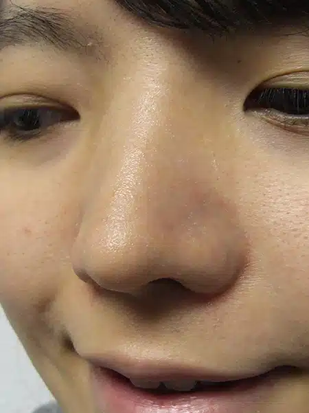 A close up of the nose and face of a person.