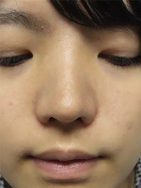 A close up of the face of a person with black hair.