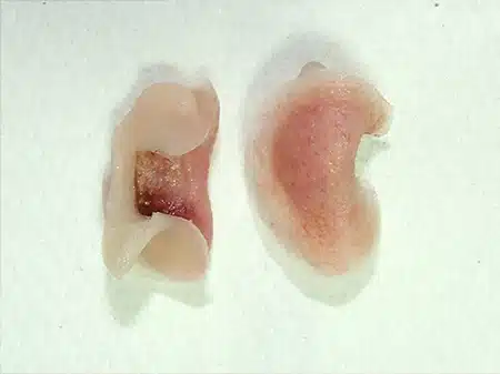 A picture of the inside of an ear.