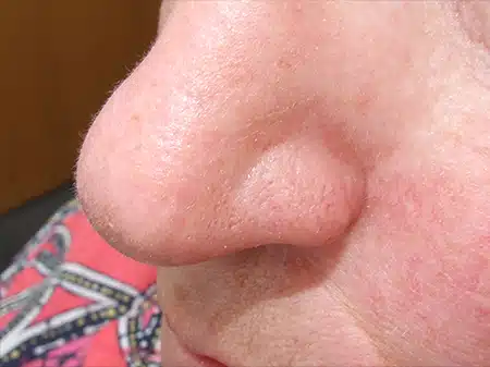 A close up of the nose and tip of a person