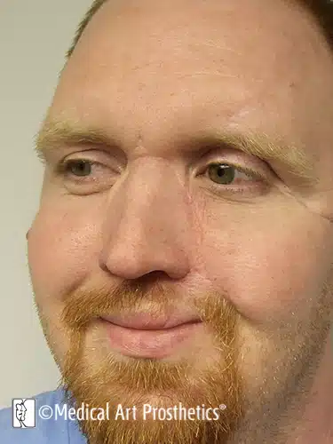 A man with red hair and beard wearing glasses.