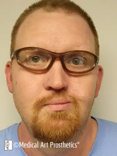 A man with red hair and glasses is looking at the camera.