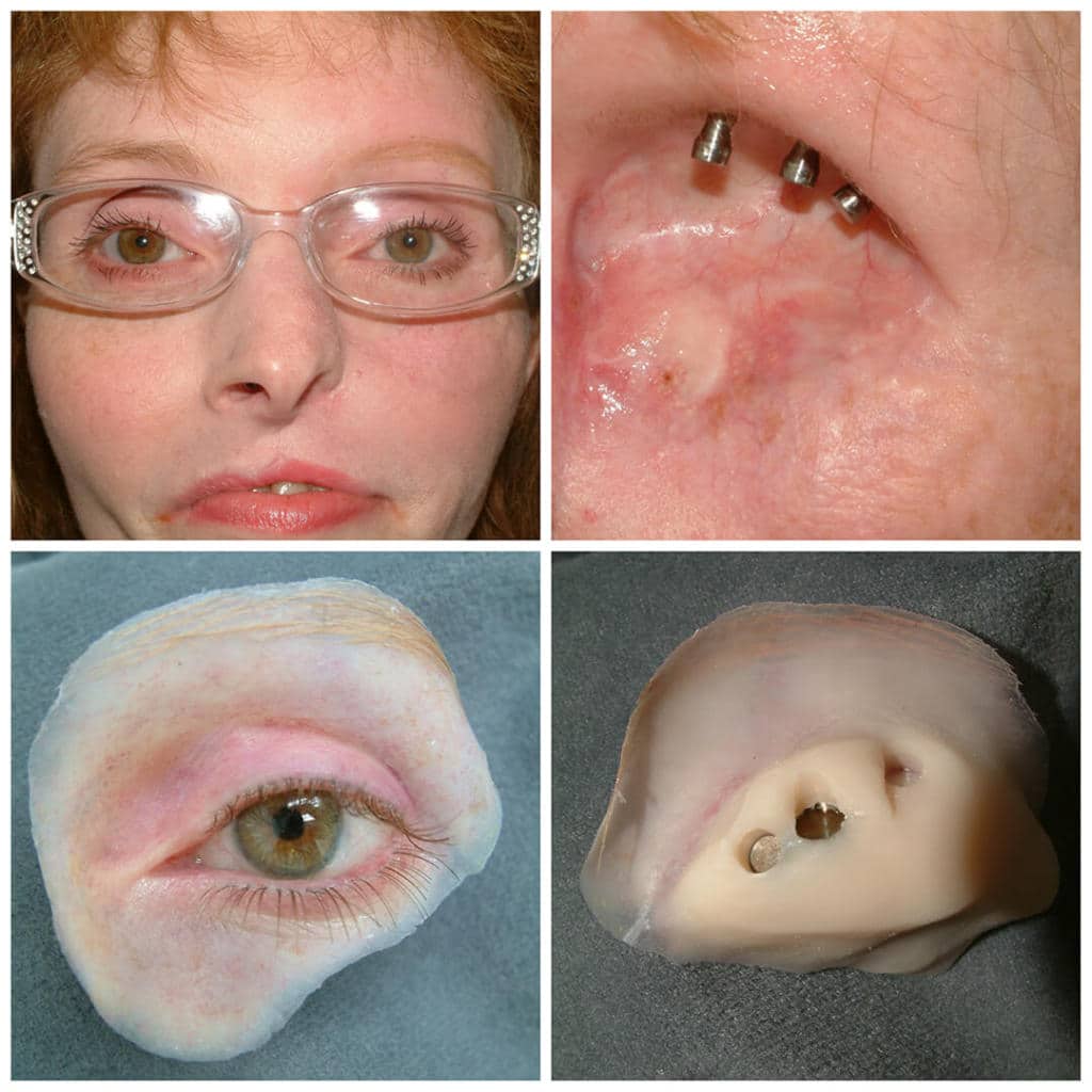 custom prosthetic eyes prosthetic eye that can see
