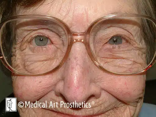 A close up of an old woman 's face with glasses