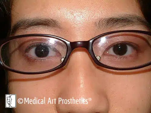 A close up of the face and glasses of a person