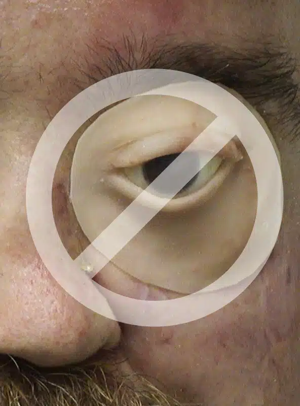 A close up of an ear with a no sign in the middle