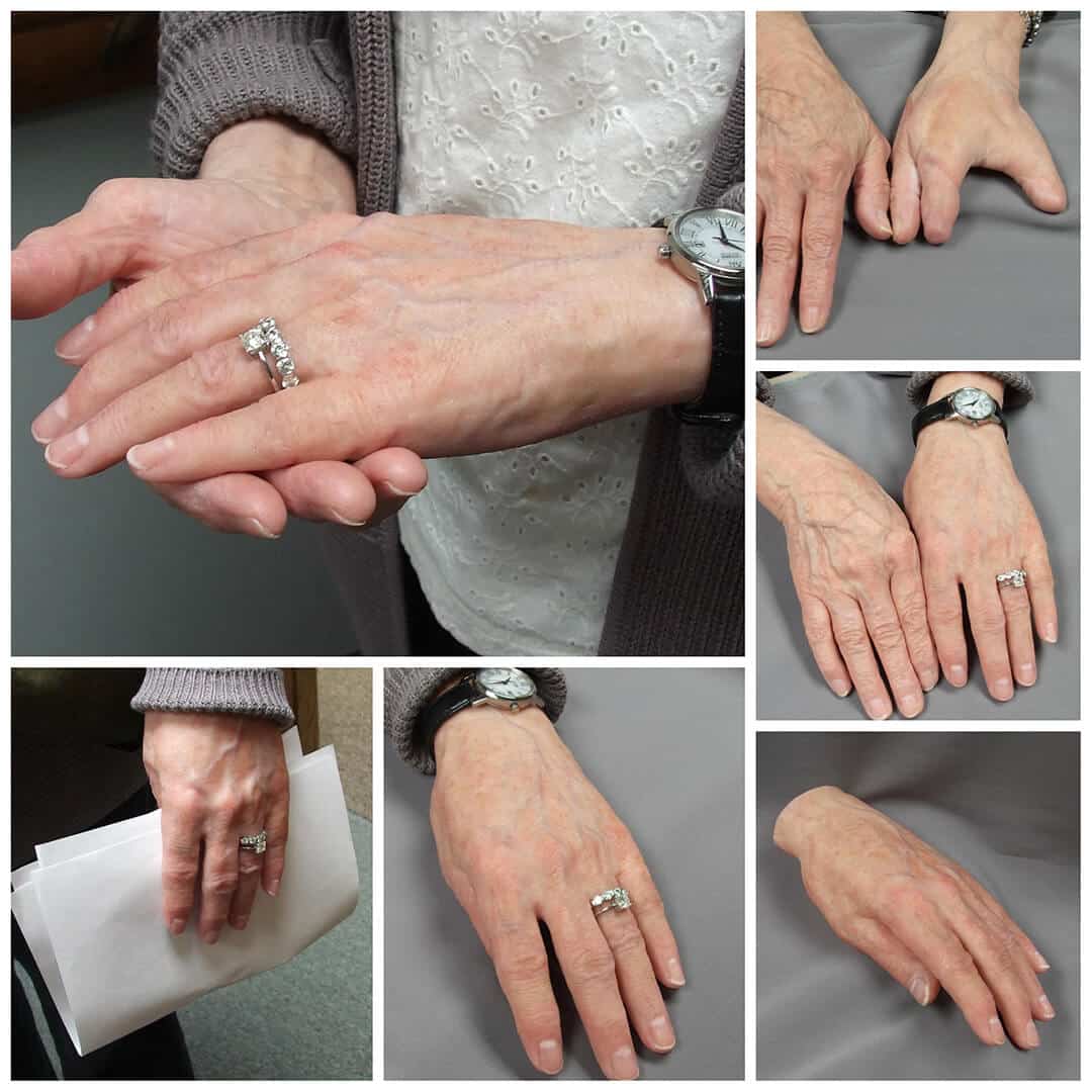 somatic-hand-gallery-3