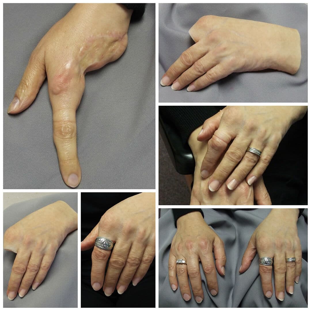 somatic-hand-testimonial-1