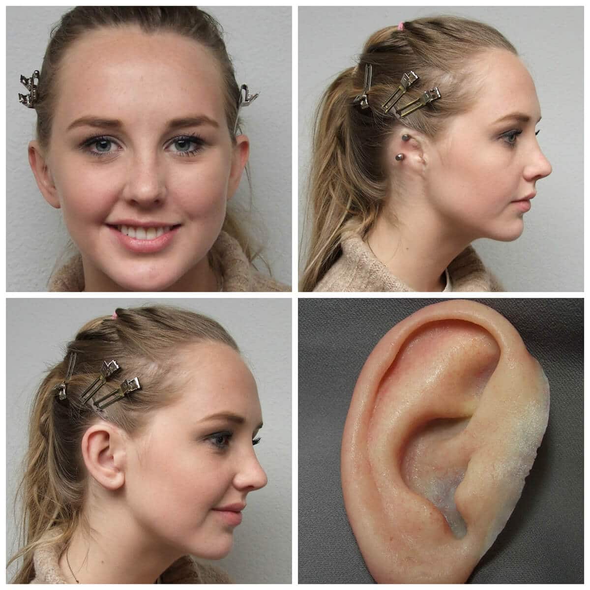 ear-gallery-40