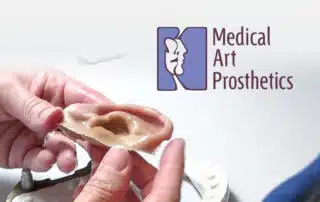 A person holding an ear with the logo of medical art prosthetic.