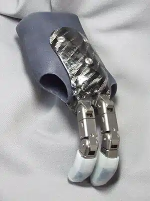 A Titan hand prosthesis