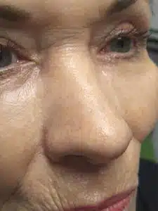 A close up of an older woman 's face