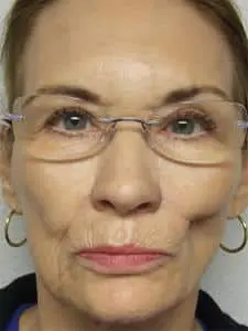 A woman with glasses and no makeup on.