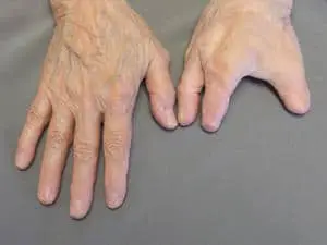 A person with white hair and hands on top of their body.