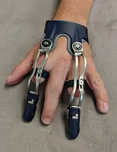A person wearing a Naked Prosthetics articulating finger prosthesis