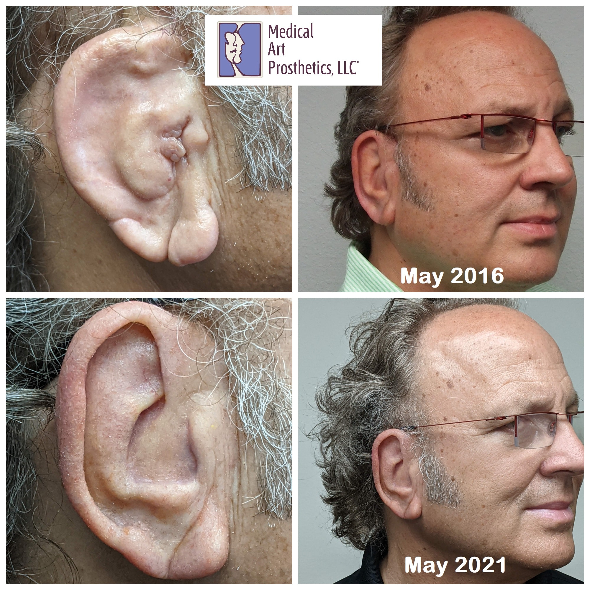 Ear-Buzz_5years
